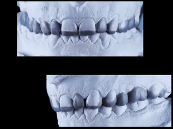 Digitalis Estudio Dental trabajos realizados