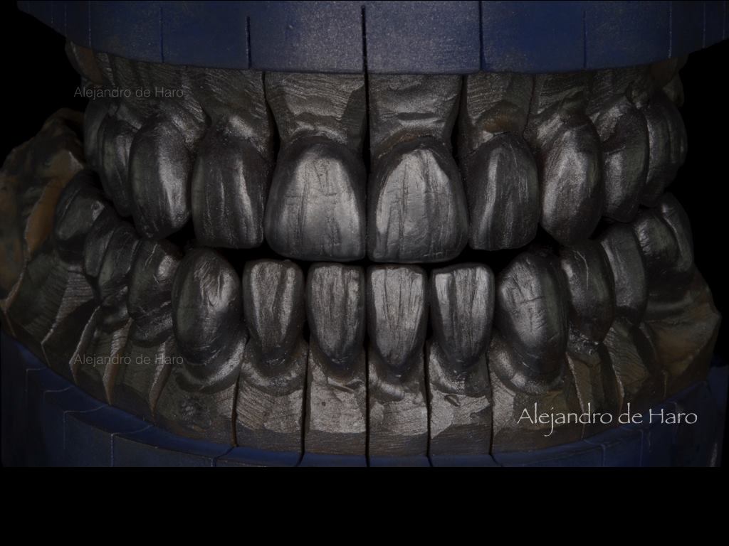 Digitalis Estudio Dental persona sonriendo